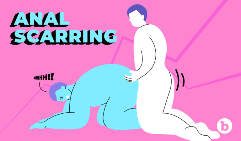 Anal Scarring