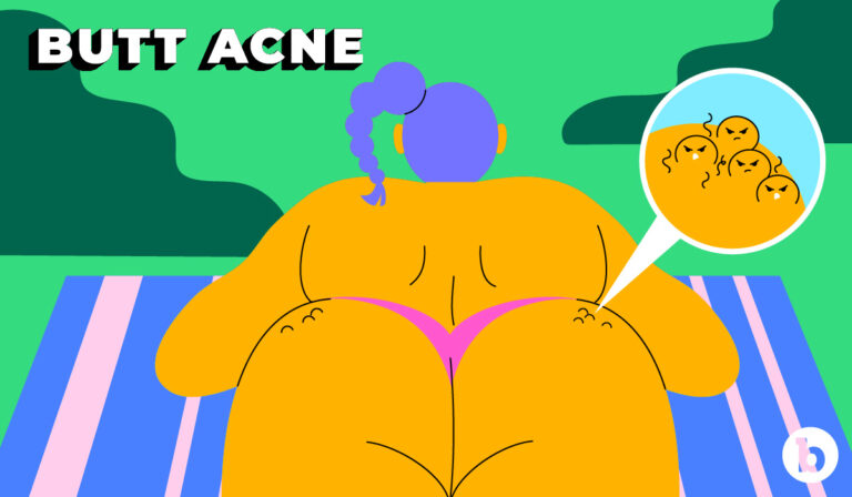 Butt Acne