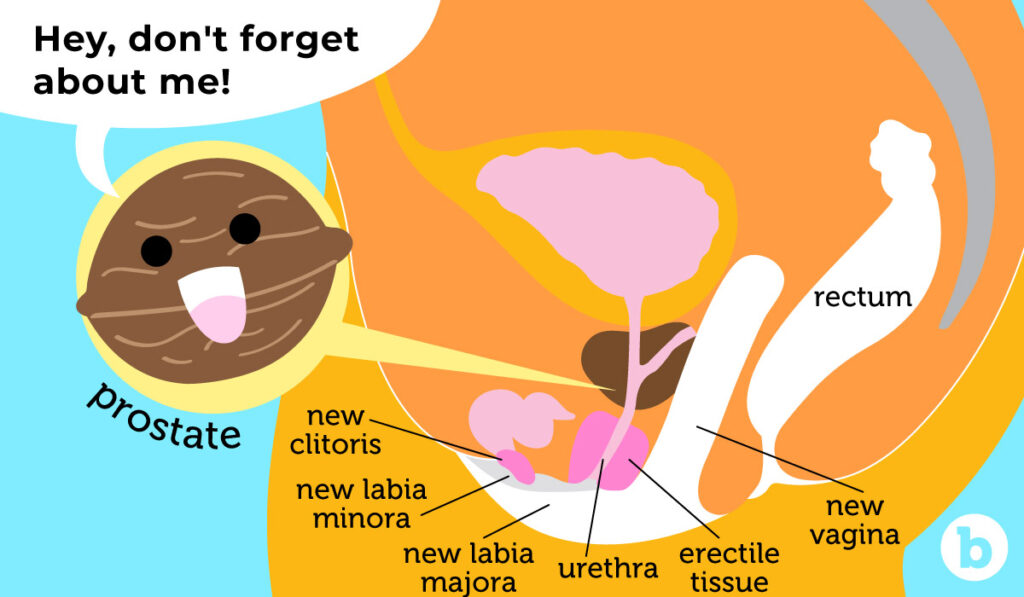 Prostate Activation, Health, and Pleasure for Trans Women Post-Op